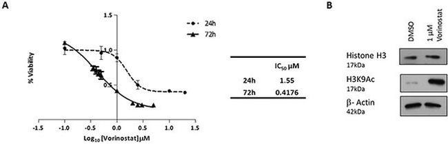 H3K9ac Antibody in Western Blot (WB)