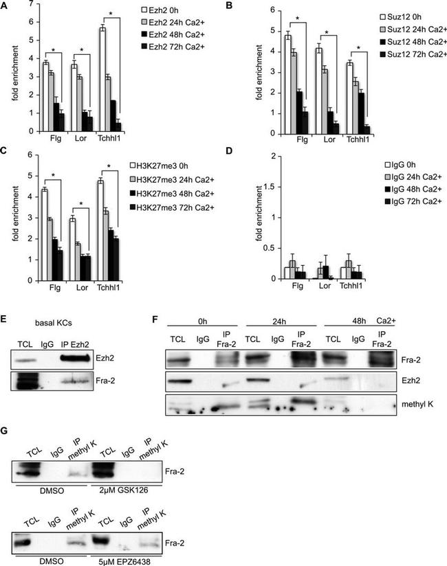 H3K27me3S28ph Antibody in ChIP Assay (ChIP)