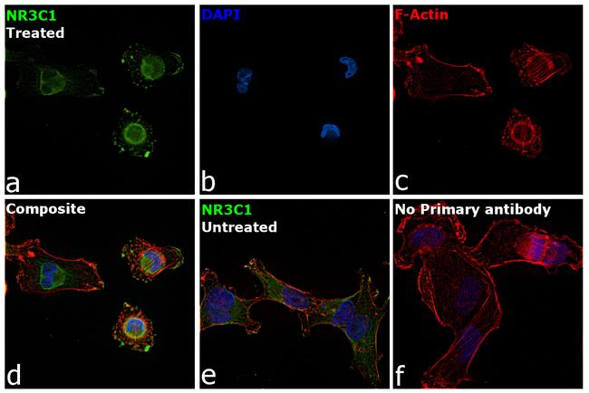 Glucocorticoid Receptor Antibody