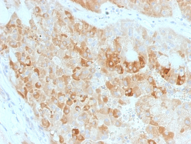 ROR2 Antibody in Immunohistochemistry (Paraffin) (IHC (P))