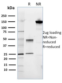 ROR2 Antibody in SDS-PAGE (SDS-PAGE)