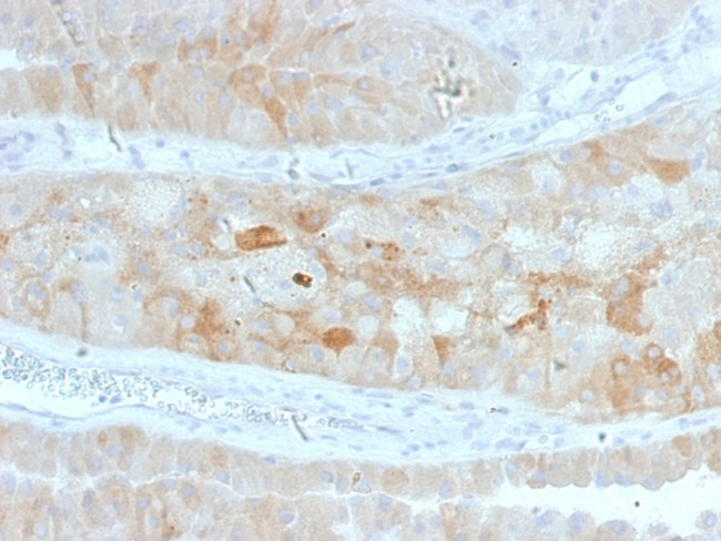 ROR2 Antibody in Immunohistochemistry (Paraffin) (IHC (P))