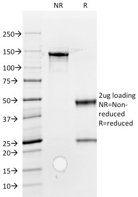 ROR2 Antibody in SDS-PAGE (SDS-PAGE)