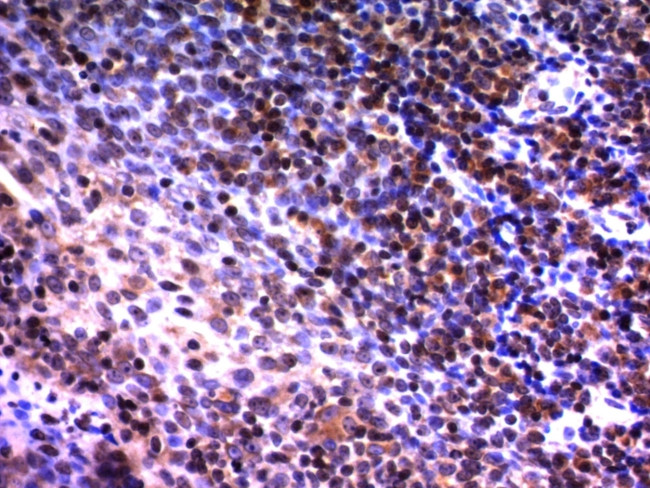 Nuclear Mitotic Apparatus Protein (NuMA) Antibody in Immunohistochemistry (Paraffin) (IHC (P))