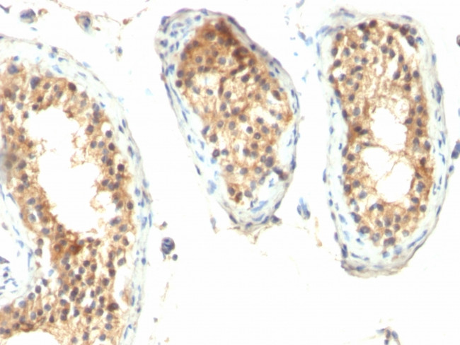 Ornithine Decarboxylase-1 (ODC-1) Antibody in Immunohistochemistry (Paraffin) (IHC (P))