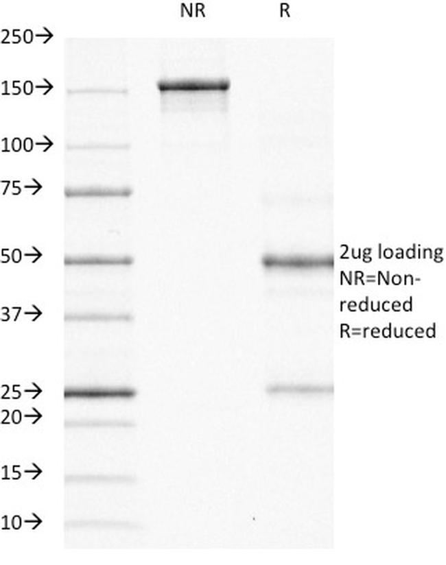 Ornithine Decarboxylase-1 (ODC-1) Antibody in SDS-PAGE (SDS-PAGE)