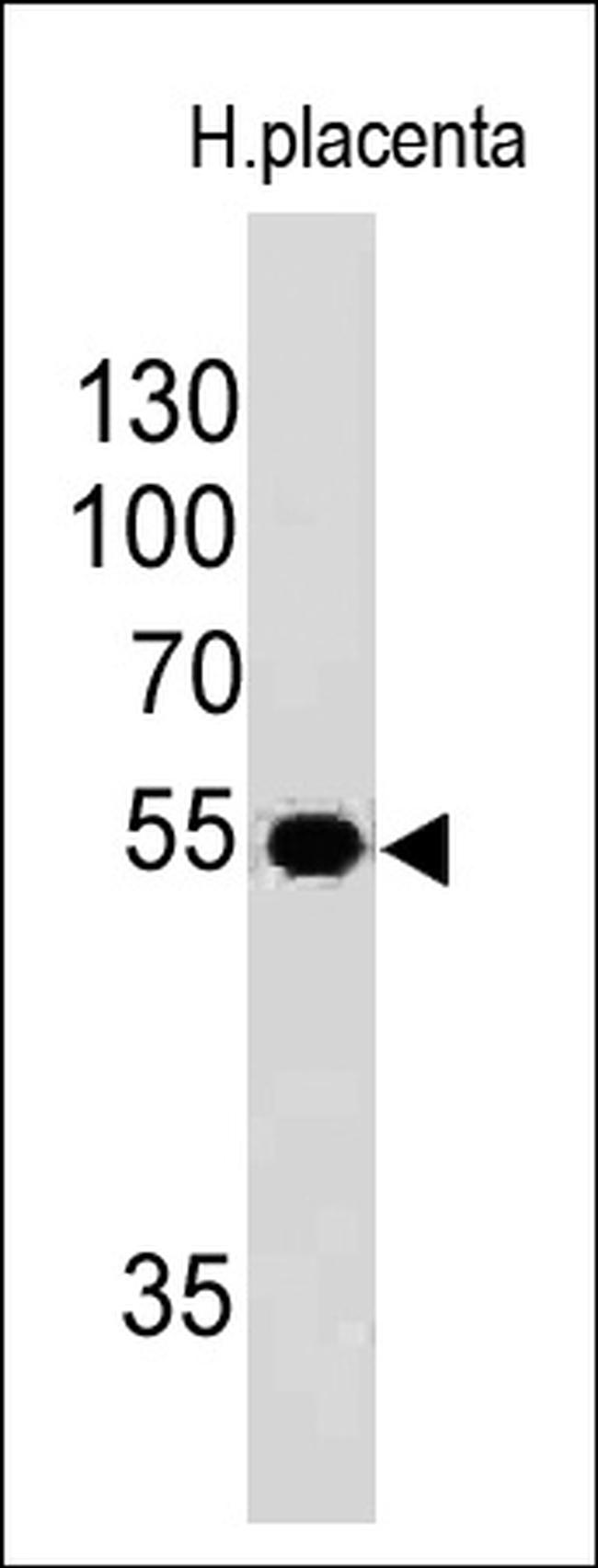 Ornithine Decarboxylase-1 (ODC-1) Antibody in Western Blot (WB)