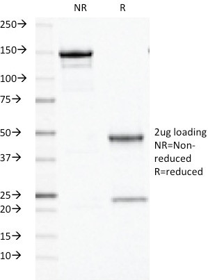 Ornithine Decarboxylase-1 (ODC-1) Antibody in SDS-PAGE (SDS-PAGE)