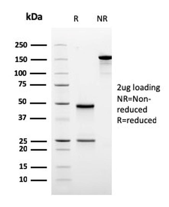 Ornithine Decarboxylase-1 (ODC-1) Antibody in SDS-PAGE (SDS-PAGE)