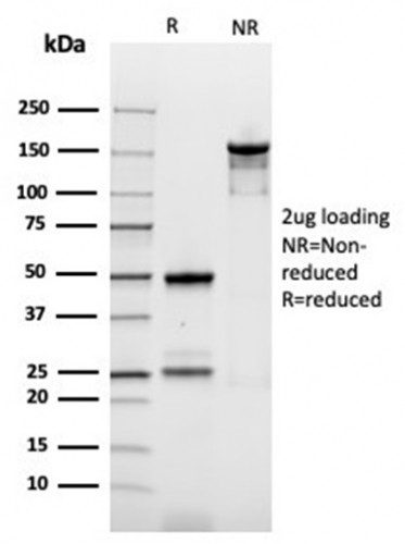 Ornithine Decarboxylase-1 (ODC-1) Antibody in SDS-PAGE (SDS-PAGE)
