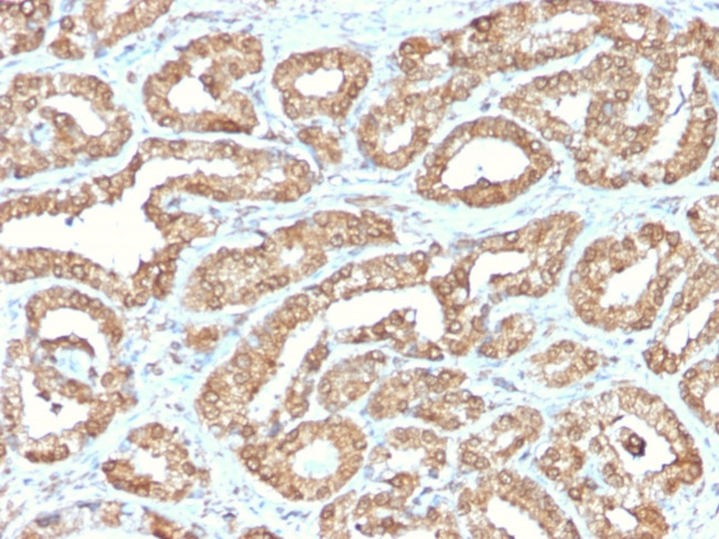 Ornithine Decarboxylase-1 (ODC-1) Antibody in Immunohistochemistry (Paraffin) (IHC (P))