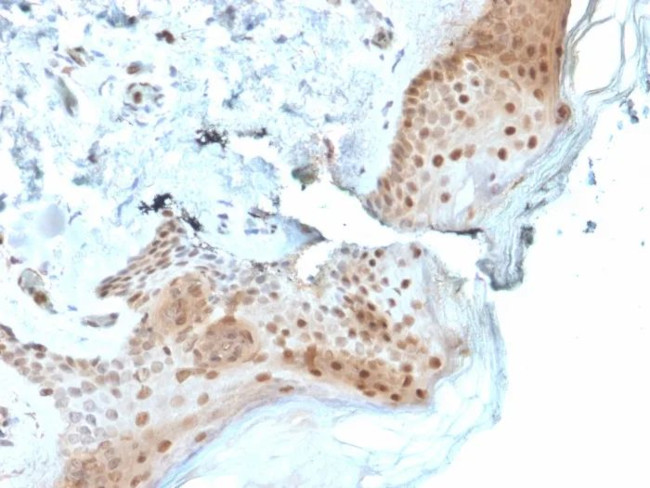 8-Oxoguanine DNA Glycosylase Antibody in Immunohistochemistry (Paraffin) (IHC (P))