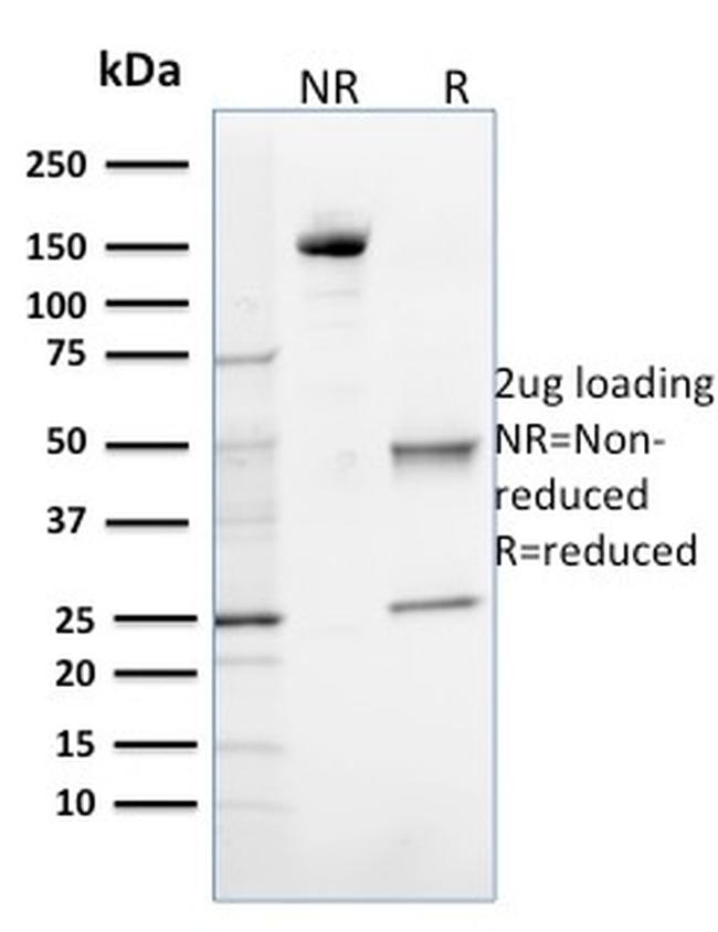 8-Oxoguanine DNA Glycosylase Antibody in SDS-PAGE (SDS-PAGE)