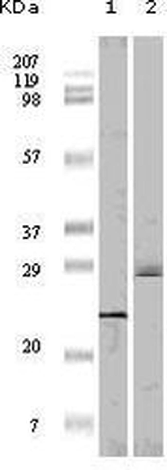 4EBP1 Antibody in Western Blot (WB)