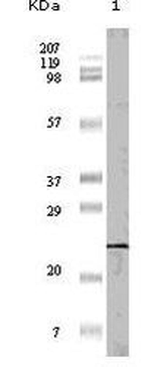 4EBP1 Antibody in Western Blot (WB)