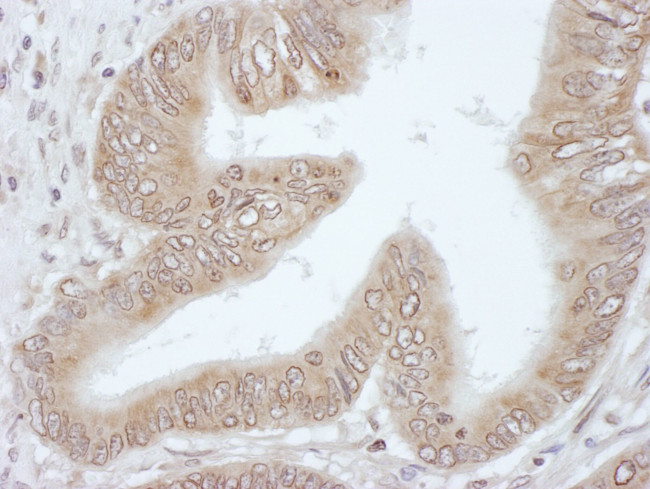 4E-T/eIF4E-T Antibody in Immunohistochemistry (IHC)