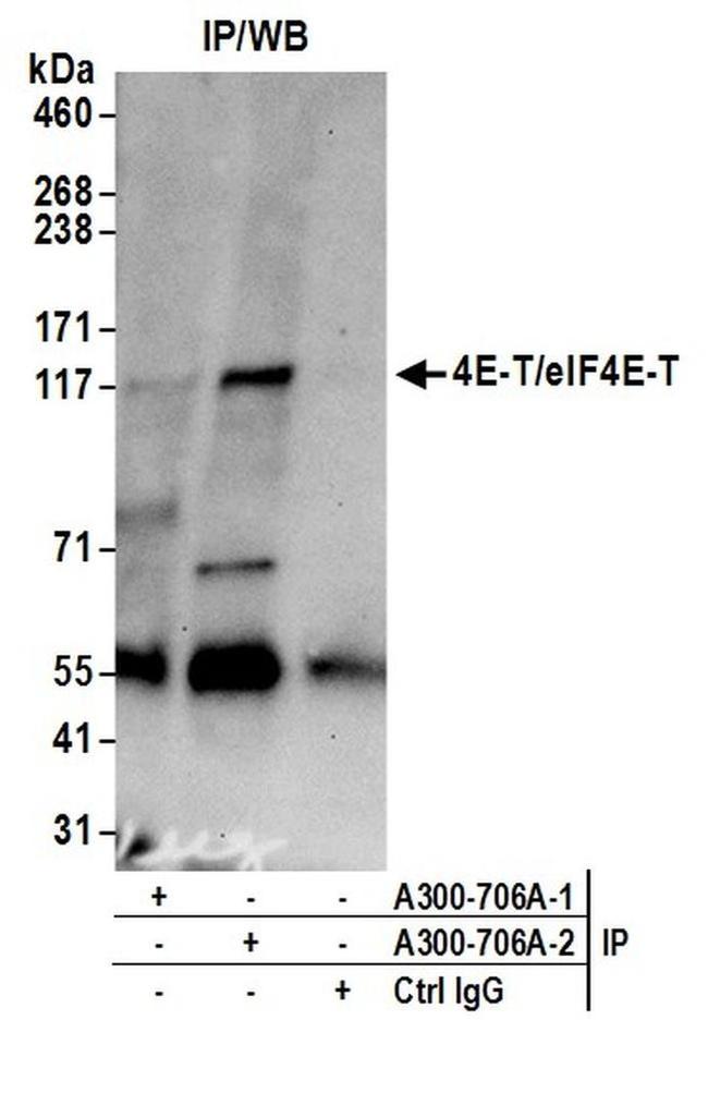 4E-T/eIF4E-T Antibody in Western Blot (WB)