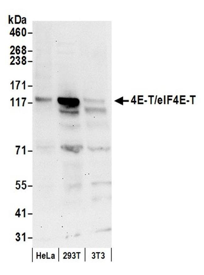 4E-T/eIF4E-T Antibody in Western Blot (WB)