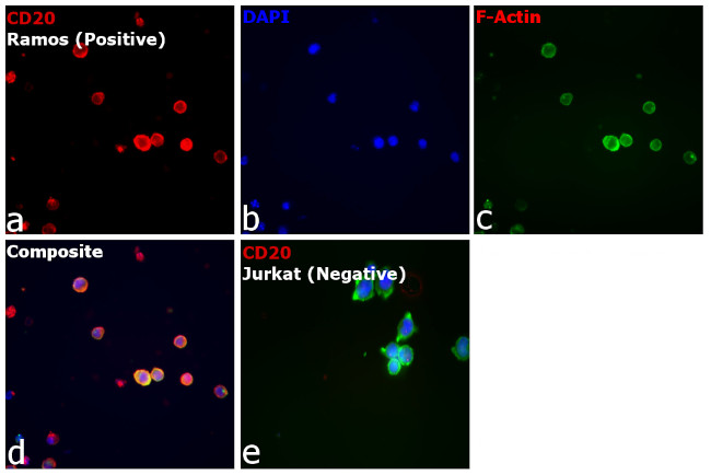 CD20 Antibody in Immunocytochemistry (ICC/IF)