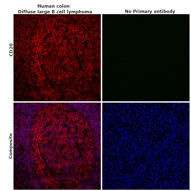 CD20 Antibody in Immunohistochemistry (Paraffin) (IHC (P))