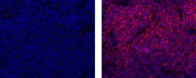 CD20 Antibody in Immunohistochemistry (Paraffin) (IHC (P))