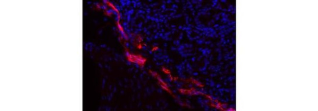 LYVE1 Antibody in Immunohistochemistry (Frozen) (IHC (F))