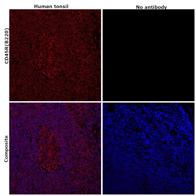 CD45R (B220) Antibody in Immunohistochemistry (Paraffin) (IHC (P))