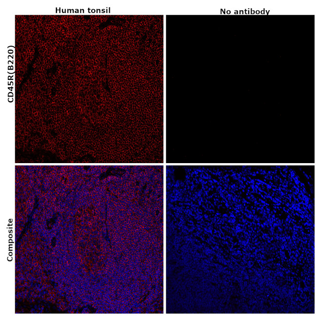 CD45R (B220) Antibody in Immunohistochemistry (Paraffin) (IHC (P))