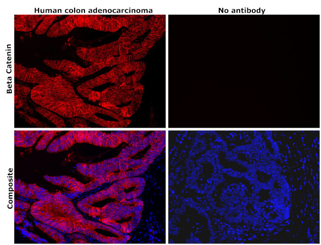 beta Catenin Antibody in Immunohistochemistry (Paraffin) (IHC (P))