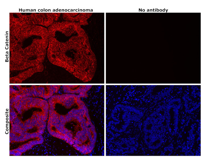 beta Catenin Antibody in Immunohistochemistry (Paraffin) (IHC (P))