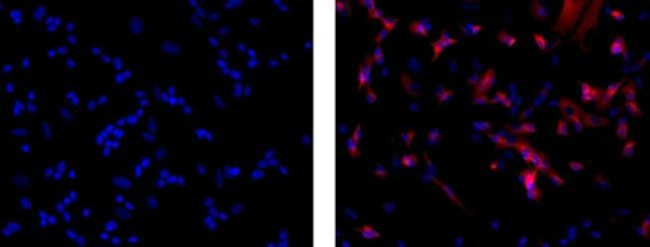 beta-3 Tubulin Antibody in Immunocytochemistry (ICC/IF)