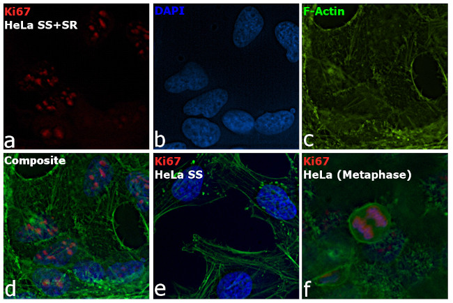 Ki-67 Antibody in Immunocytochemistry (ICC/IF)