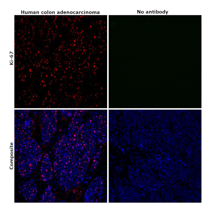 Ki-67 Antibody in Immunohistochemistry (Paraffin) (IHC (P))