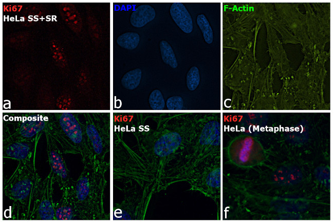 Ki-67 Antibody in Immunocytochemistry (ICC/IF)