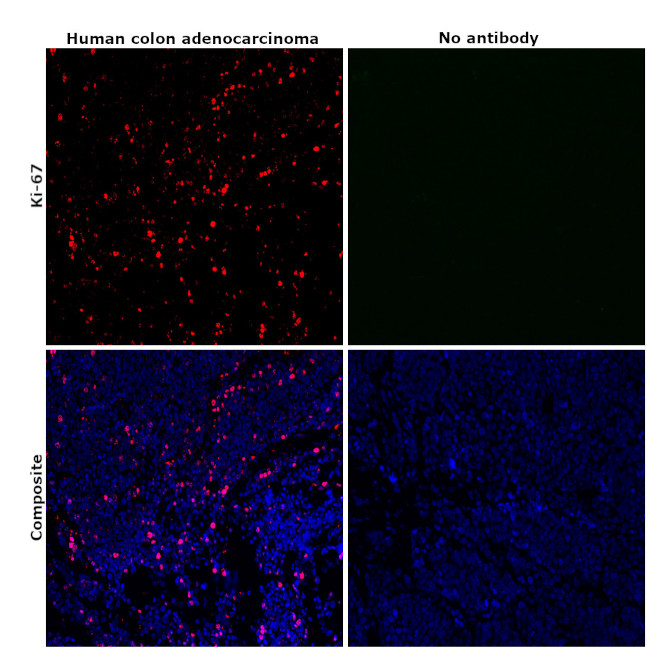 Ki-67 Antibody in Immunohistochemistry (Paraffin) (IHC (P))