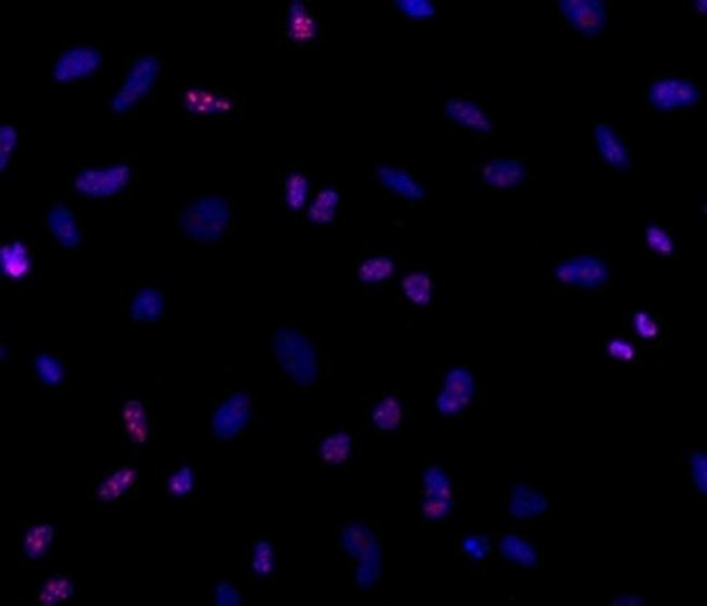 Ki-67 Antibody in Immunocytochemistry (ICC/IF)