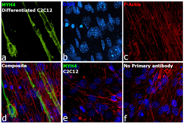 Myosin 4 Antibody in Immunocytochemistry (ICC/IF)