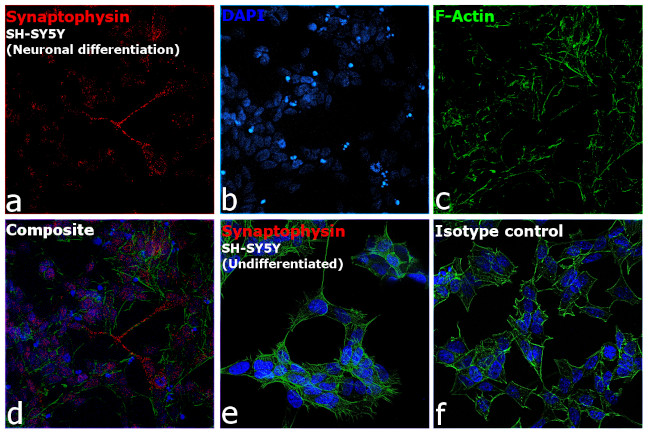 Synaptophysin Antibody in Immunocytochemistry (ICC/IF)