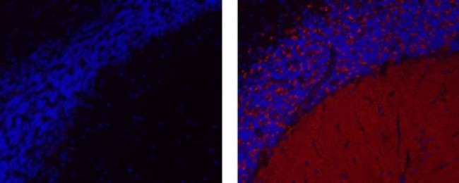 Synaptophysin Antibody in Immunohistochemistry (Paraffin) (IHC (P))