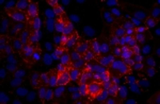 SSEA4 Antibody in Immunocytochemistry (ICC/IF)