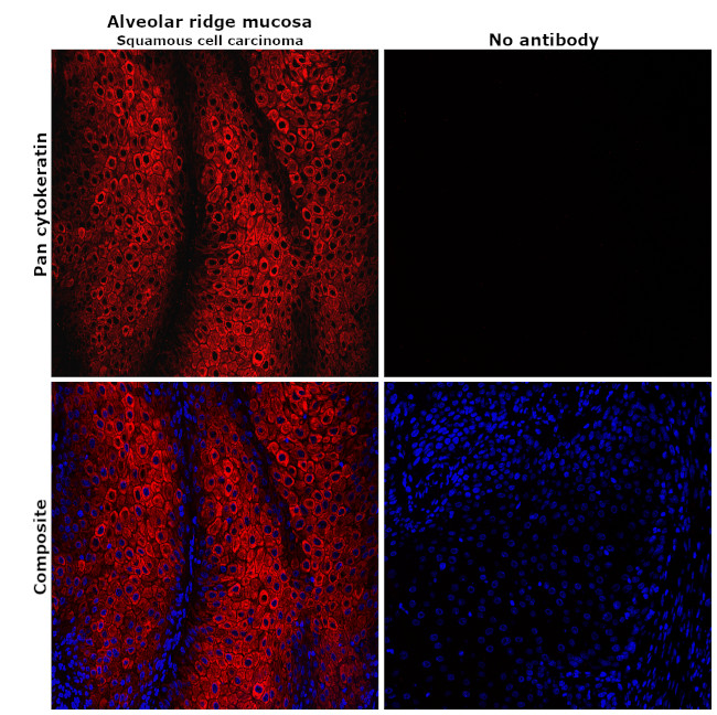 Pan Cytokeratin Antibody in Immunohistochemistry (Paraffin) (IHC (P))