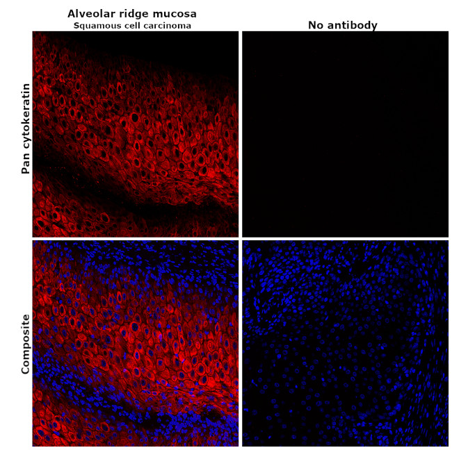 Pan Cytokeratin Antibody in Immunohistochemistry (Paraffin) (IHC (P))