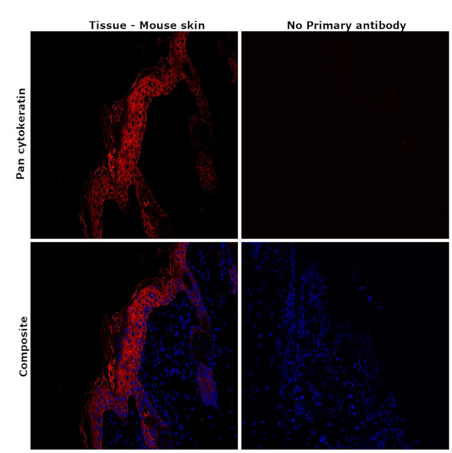 Pan Cytokeratin Antibody in Immunohistochemistry (Paraffin) (IHC (P))