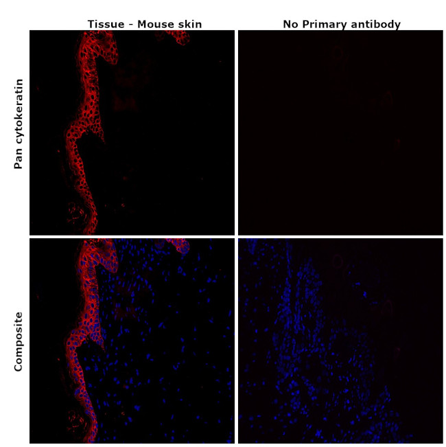 Pan Cytokeratin Antibody in Immunohistochemistry (Paraffin) (IHC (P))