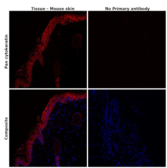 Pan Cytokeratin Antibody in Immunohistochemistry (Paraffin) (IHC (P))