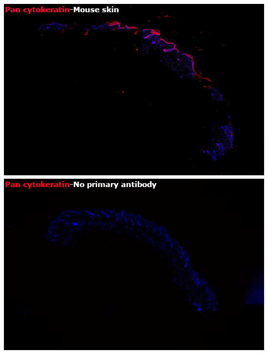 Pan Cytokeratin Antibody in Immunohistochemistry (Paraffin) (IHC (P))