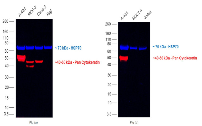 Pan Cytokeratin Antibody