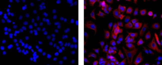 Pan Cytokeratin Antibody in Immunocytochemistry (ICC/IF)