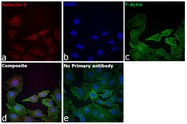 Galectin 9 Antibody in Immunocytochemistry (ICC/IF)