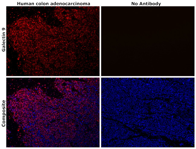 Galectin 9 Antibody in Immunohistochemistry (Paraffin) (IHC (P))